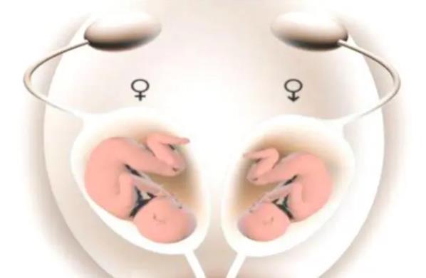 <b>卵巢早衰调理到试管得龙凤胎，真实案例分享</b>